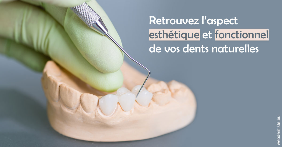 https://dr-christophe-hollebecque.chirurgiens-dentistes.fr/Restaurations dentaires 1