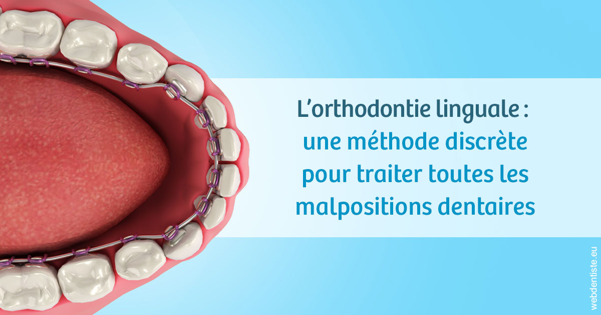 https://dr-christophe-hollebecque.chirurgiens-dentistes.fr/L'orthodontie linguale 1