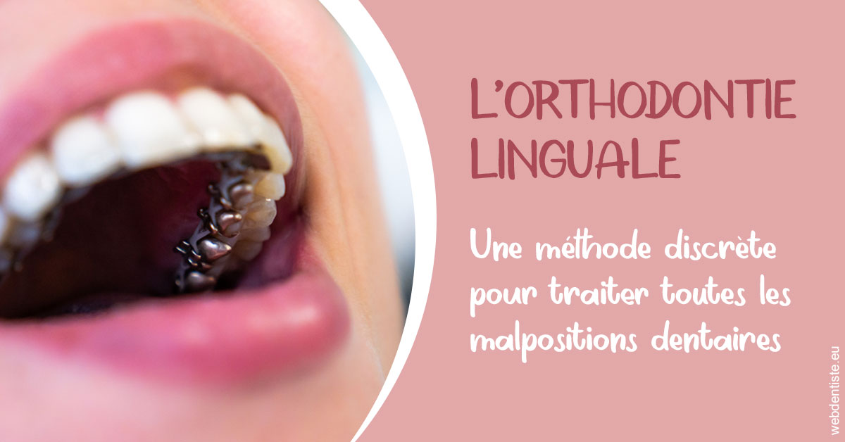https://dr-christophe-hollebecque.chirurgiens-dentistes.fr/L'orthodontie linguale 2