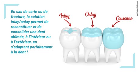 https://dr-christophe-hollebecque.chirurgiens-dentistes.fr/L'INLAY ou l'ONLAY