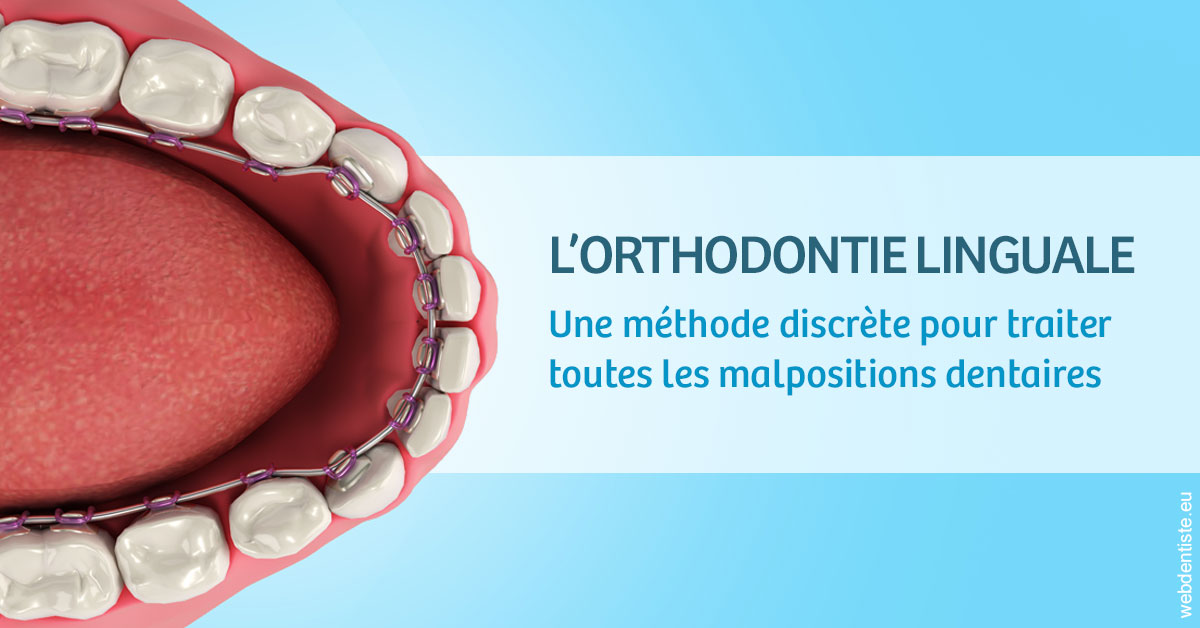 https://dr-christophe-hollebecque.chirurgiens-dentistes.fr/L'orthodontie linguale 1