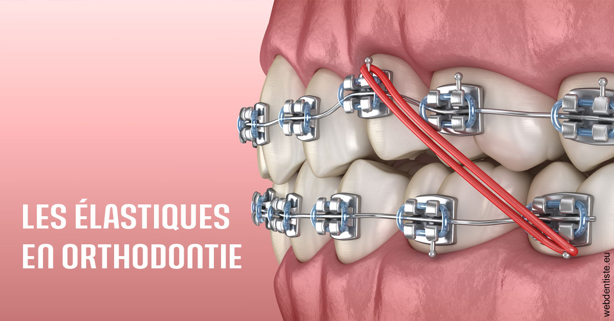 https://dr-christophe-hollebecque.chirurgiens-dentistes.fr/Elastiques orthodontie 2