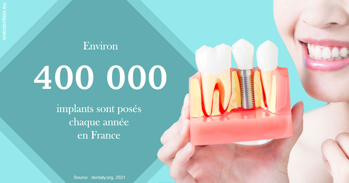 https://dr-christophe-hollebecque.chirurgiens-dentistes.fr/Pose d'implants en France 2